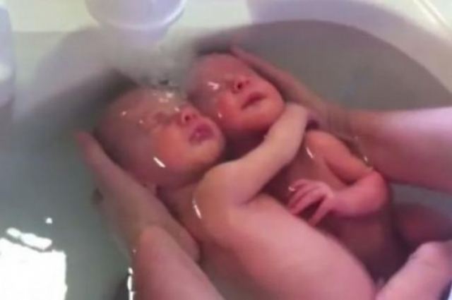 Νεογέννητα δίδυμα αγκαλιάζονται ενώ τα κάνουν μπάνιο (βίντεο)