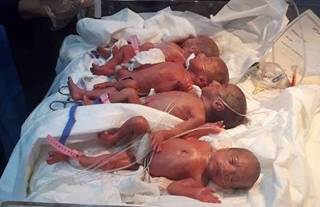 25χρονη γέννησε με φυσιολογικό τοκετό 7 μωρά! 6 κορίτσια και ένα αγόρι!