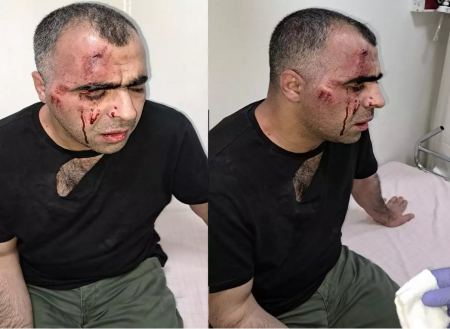 Τουρκία: Άγριος ξυλοδαρμός δημοσιογράφου από σωματοφύλακες δημάρχου