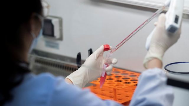 Κορωνοϊός: Νέο τεστ αίματος δίνει αποτελέσματα σε 15 λεπτά - Θα έρθει και στην Ελλάδα