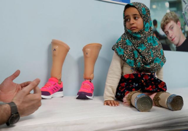 Συγκλονιστική ιστορία ενός 8χρονου ανάπηρου κοριτσιού από τη Συρία – Περπατούσε με κονσερβοκούτια – video – [pics]