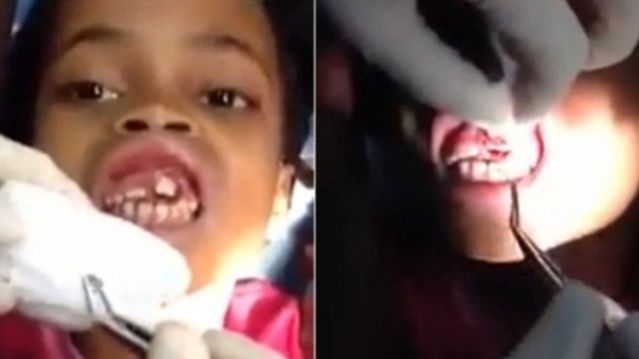 Βίντεο: Έβγαλαν 15 σκουλήκια από το στόμα 10χρονης (ΠΡΟΣΟΧΗ, ΣΚΛΗΡΕΣ ΕΙΚΟΝΕΣ)