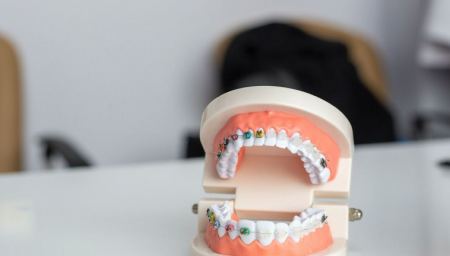 Dentist Pass: Πότε ξεκινούν οι αιτήσεις για δωρεάν επίσκεψη σε οδοντίατρο