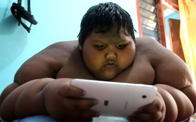 Το πιο παχύσαρκο παιδί στον κόσμο έχασε τα μισά του κιλά