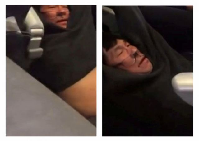 Δικαίωση! Η United Airlines πληρώνει τον γιατρό για τη βίαιη απομάκρυνση από πτήση