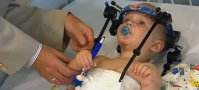 Χειρουργικό θαύμα: Παιδί 16 μηνών υπέστη εσωτερικό αποκεφαλισμό και τα κατάφερε (ΦΩΤΟ)