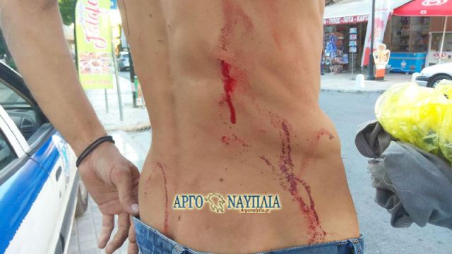 Αιματηρός καβγάς πριν λίγο στο Ναύπλιο …(ΦΩΤΟ)