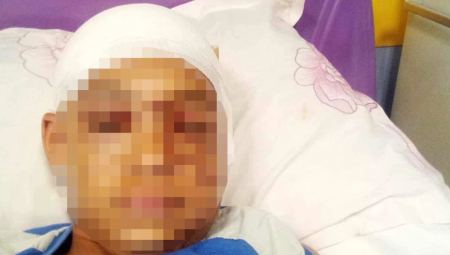 Επίθεση πίτμπουλ σε 11χρονο: Συγκλονίζει ο πατέρας του - «Έδωσε μάχη, έκανε 3 ώρες χειρουργείο»