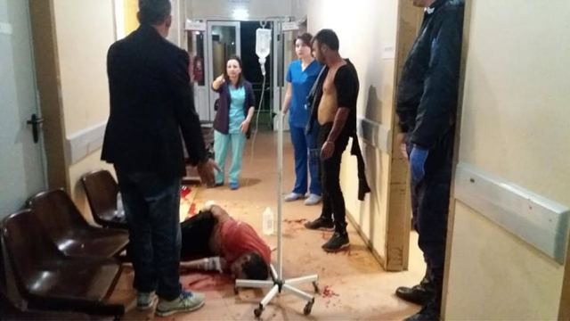 Εικόνες σοκ: Μεθυσμένος Ρομά επιτέθηκε σε γιατρό - Σκληρές εικόνες!