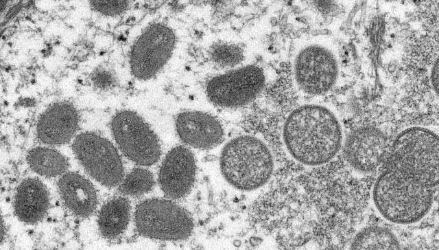 Μόσιαλος για ευλογιά των πιθήκων: Τι γνωρίζουμε ως τώρα για τον ιό