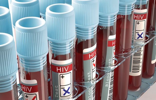 Γιατρός κατηγορείται ότι μόλυνε με τον ιό του HIV 90 ανθρώπους