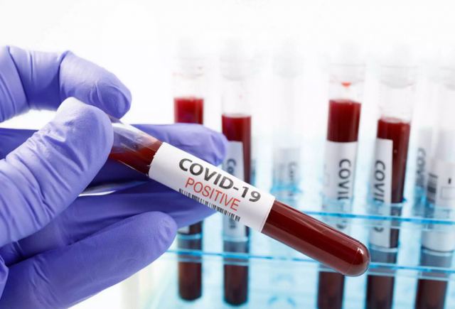 Κορωνοϊός: Εξέταση αίματος εντοπίζει με ακρίβεια τους ασθενείς με long covid
