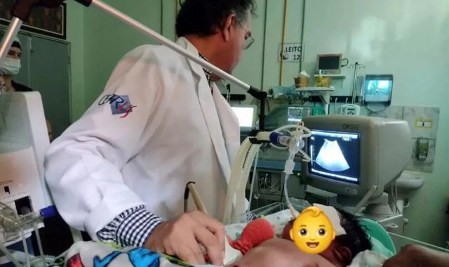 Βραζιλία: Γεννήθηκε μωρό βάρους 7,3 κιλών - «Δεν περίμενα τέτοια έκπληξη», λέει η μητέρα
