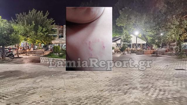 Λαμία: Σκύλος επιτέθηκε σε παιδάκι μέσα στην πλατεία