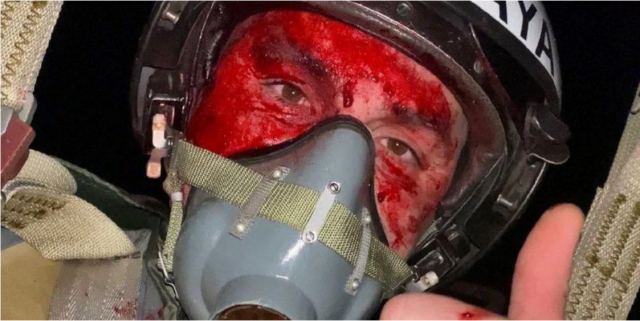 H απίστευτη selfie που τράβηξε Ουκρανός πιλότος με ματωμένο πρόσωπο και το μαχητικό του στις φλόγες!