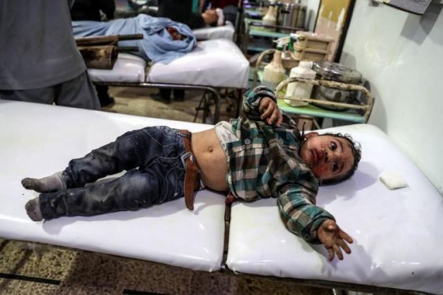 Συρία – Εικόνες σοκ από νέους βομβαρδισμούς! Παιδιά μέσα στα αίματα και τα χώματα