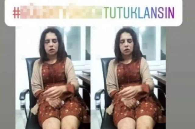 Τούρκος βιντεοσκόπησε τον ξυλοδαρμό της ερωμένη του για να ζητήσει… συγγνώμη από τη σύζυγό του (pics, vid)