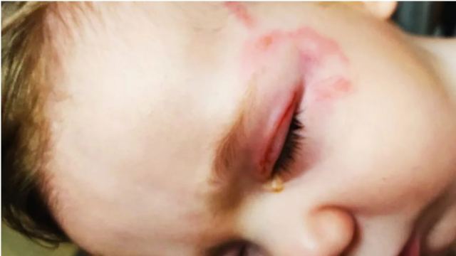 Κρήτη: Συγκλονίζει ο πατέρας του βρέφους για την επίθεση από λυκόσκυλο - «Δάγκωνε με μανία το παιδί μου»