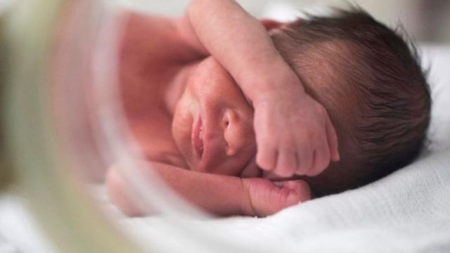 Γέννηση μωρού χωρίς πρόσωπο συνταράσσει την Πορτογαλία