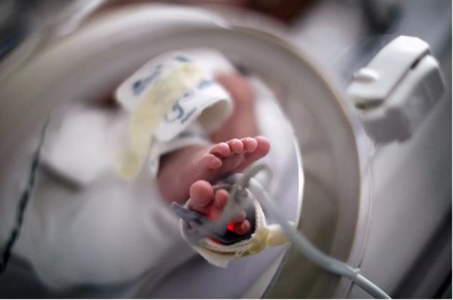 Βραζιλία: Μωρό γεννήθηκε με «ανθρώπινη ουρά» 12 εκατοστών