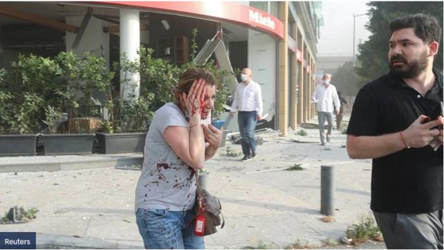 Εκρηξη στη Βηρυτό: &quot;Εχασα το μάτι μου, η χώρα πέθανε&quot;, λέει Ελληνίδα τραυματίας