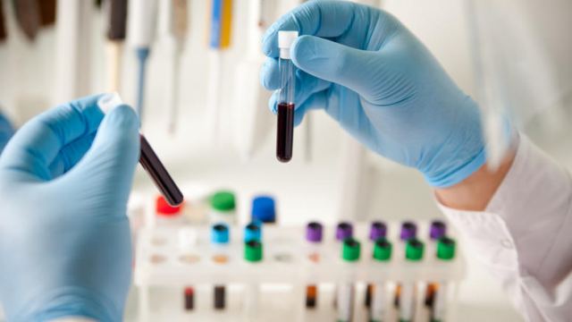Ένα απλό τεστ αίματος ανιχνεύει οκτώ διαφορετικούς καρκίνους
