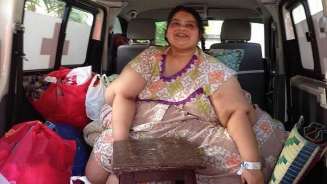 H πιο παχιά γυναίκα της Ασίας ... αδυνάτισε έπειτα από δύο επεμβάσεις - Έχασε 210 κιλά - ΦΩΤΟ