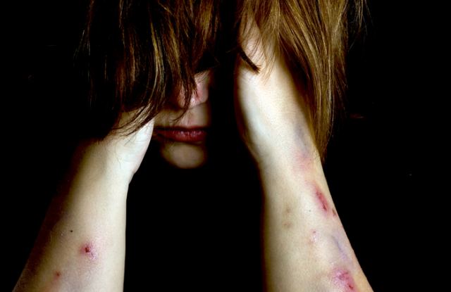 Τυφλή βία μεταξύ αλλοδαπών! Χτύπησαν γυναίκα και της έκοψαν τα μαλλιά