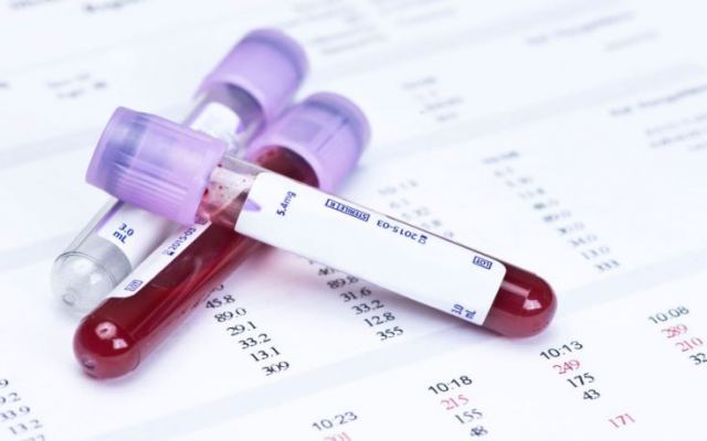 Το πρώτο τεστ αίματος που ανιχνεύει ταυτόχρονα οκτώ είδη καρκίνου