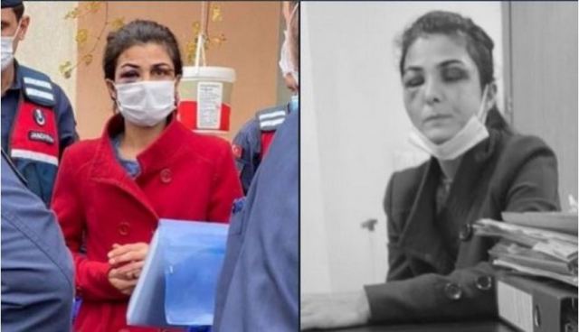 Τουρκία: &quot;Ελευθερώστε τη Μελέκ Ιπέκ&quot; - Η γυναίκα που σκότωσε τον άντρα-βασανιστή της και κρατείται στη φυλακή