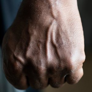 Γιαννιτσά: Νεκρός ο 27χρονος που νοσηλευόταν μετά από καβγά σε μπαρ – Είχε πέσει στο έδαφος μετά από μπουνιά από 26χρονο