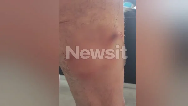 Ο σκύλος της οικογένειας Τσιτσιπά επιτέθηκε σε ηλικιωμένο έξω από καφετέρια – Είχε επιτεθεί ξανά το 2023 σε μαθητή