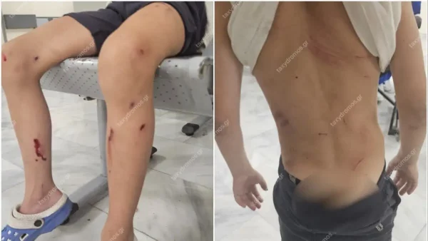 Στο νοσοκομείο 7χρονος μετά από επίθεση σκυλιών - «Παραλίγο να το κατασπαράξουν» λέει η μητέρα του