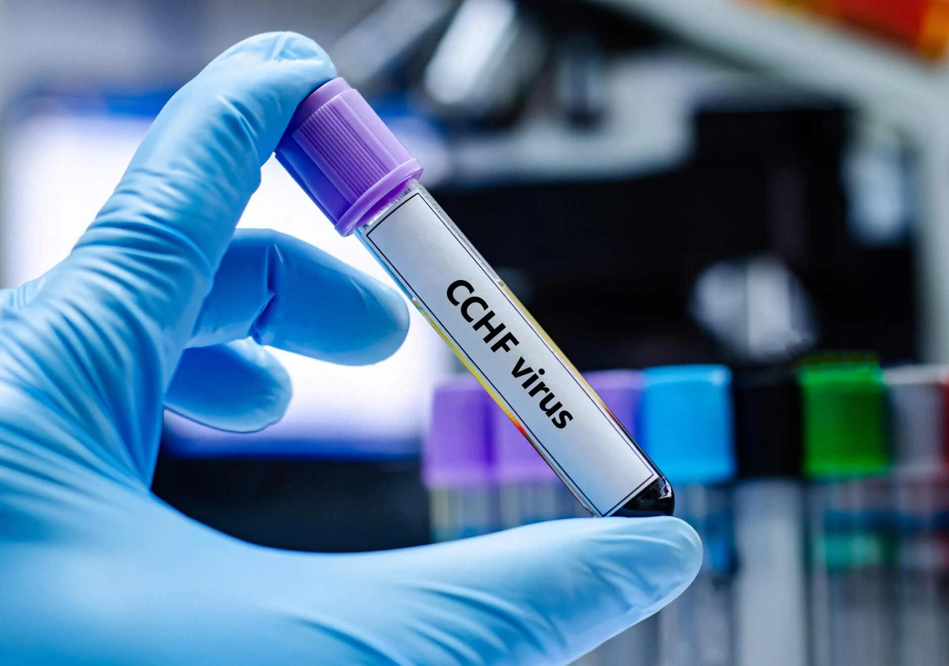 Ενημέρωση σχετικά με τον θανατηφόρο Κριμαϊκό Αιμορραγικό Πυρετό του Κονγκό