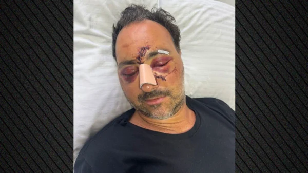 Ελεύθεροι οι δύο κατηγορούμενοι για τον ξυλοδαρμό του Ελληνοκαναδού χρηματιστή στο Ηράκλειο