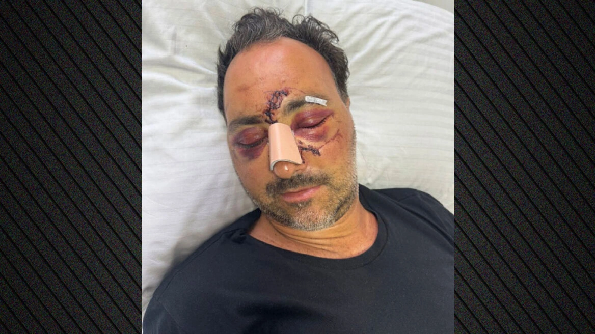 Ελεύθεροι οι δύο κατηγορούμενοι για τον ξυλοδαρμό του Ελληνοκαναδού χρηματιστή στο Ηράκλειο