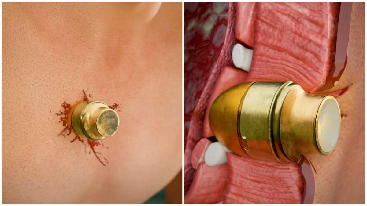 Στρατιώτης επέζησε με χειροβομβίδα στο στήθος του: Προσομοίωση εξηγεί πως τα κατάφερε (video)