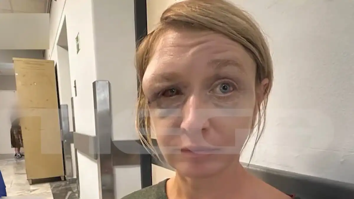 «Έχουμε σχέση αγάπης με τον σύντροφό μου» λέει η 40χρονη που ξυλοκοπήθηκε στο Κορωπί - Συγκλονίζει η εικόνα της μετά την κακοποίηση