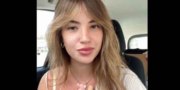 Ονειρευόταν πάντα να αποκτήσει φακίδες: Όταν τίποτε άλλο δεν πέτυχε, έκανε τατουάζ - Δείτε πώς είναι τώρα