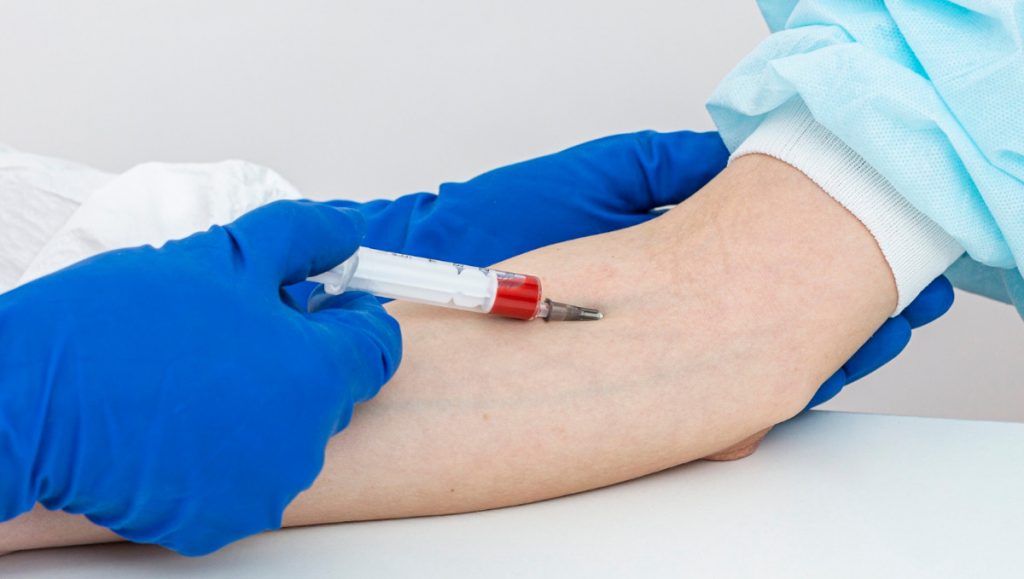 Ανακαλύφθηκε ο πιο σπάνιος τύπος αίματος: Τον έχουν 3 άτομα σε μισό εκατ. δείγματα