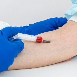 Ανακαλύφθηκε ο πιο σπάνιος τύπος αίματος: Τον έχουν 3 άτομα σε μισό εκατ. δείγματα