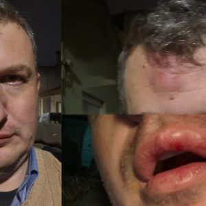 Άγριος ξυλοδαρμός εκδότη στον Βόλο - Κουκουλοφόροι τον περίμεναν έξω από το σπίτι και τον γρονθοκόπησαν