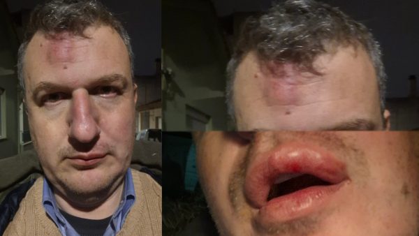 Άγριος ξυλοδαρμός εκδότη στον Βόλο - Κουκουλοφόροι τον περίμεναν έξω από το σπίτι και τον γρονθοκόπησαν