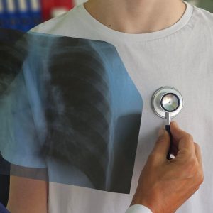 Δράση για την πρόληψη και πρώιμη διάγνωση Πνευμονικών Παθήσεων