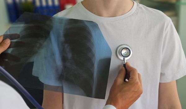 Δράση για την πρόληψη και πρώιμη διάγνωση Πνευμονικών Παθήσεων