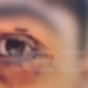 Ιωάννινα: Άγριος ξυλοδαρμός 16χρονου από ανήλικους – «Πήγε βόλτα και κινδύνευσε να χάσει την όρασή του» λέει η μητέρα του