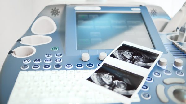 Κλινικές εξωσωματικής γονιμοποίησης στην Κύπρο χορήγησαν λάθος σπέρμα σε οικογένειες