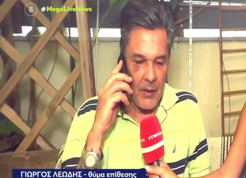 Χαϊδάρι: «Μου ‘χει σπάσει το κόκκαλο στη μύτη» λέει ο άνδρας που έπεσε θύμα ξυλοδαρμού μέσα σε ιατρείο