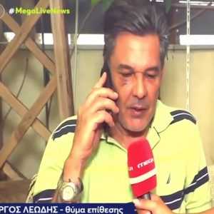 Χαϊδάρι: «Μου ‘χει σπάσει το κόκκαλο στη μύτη» λέει ο άνδρας που έπεσε θύμα ξυλοδαρμού μέσα σε ιατρείο