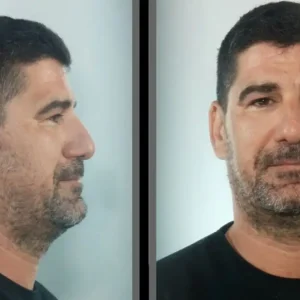 Κεφαλονιά: Στη δημοσιότητα τα στοιχεία του προπονητή που διώκεται για βιασμούς ανήλικων αθλητριών
